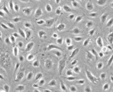 Bladder Microvascular Endothelial Cells (BMEC)