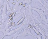 Bone Marrow-derived Mesenchymal Stem Cells (BMMSCs)
