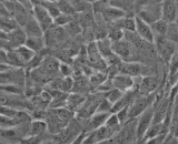 Chorionic Mesenchymal Stem Cells (CMSCs)
