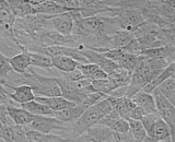 Gastric Smooth Muscle Cells (GSMC)