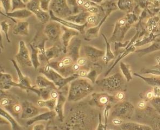 Hepatic Stellate Cells (HSC)