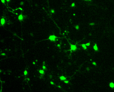 Hippocampal Neuron Cells  (HNC)
