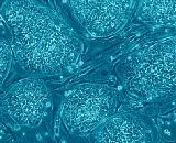 Induced Pluripotent Stem Cells (IPSC)