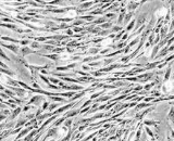 Liver-derived Mesenchymal Stem Cells (LMSCs)