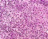 Liver Mononuclear Cells (LMC)