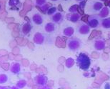 Mastocytoma Cells (MTC)