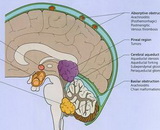 Cerebral Edema (CE)
