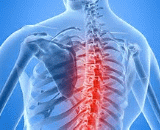 Chronic Spinal Cord Injury (CSCI)