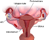 Endometriosis (EM)