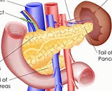 Pancreatic Microcirculatory Failure (PMF)