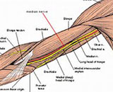 Peripheral Nerve Entrapment Syndrome (PNES)