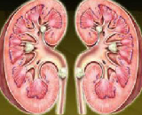 Renal Fibrosis (RF)