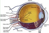 Central Retinal Vein Occlusion (CRVO)
