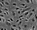 Myometrial Microvascular Endothelial Cells (MMEC)