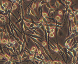 Pheochromocytoma Cells (PCC)