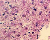 Renal Parenchymal Cells (RPC)