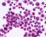 Splenocytes (SC)