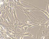 Trigeminal ganglion neuron cells (TGN)