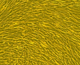 Uterine Smooth Muscle Cells (USMC)