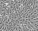 Vertebral Mesenchymal Stem Cells (VMSC)