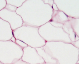 Visceral Adipose Cells (VAC)