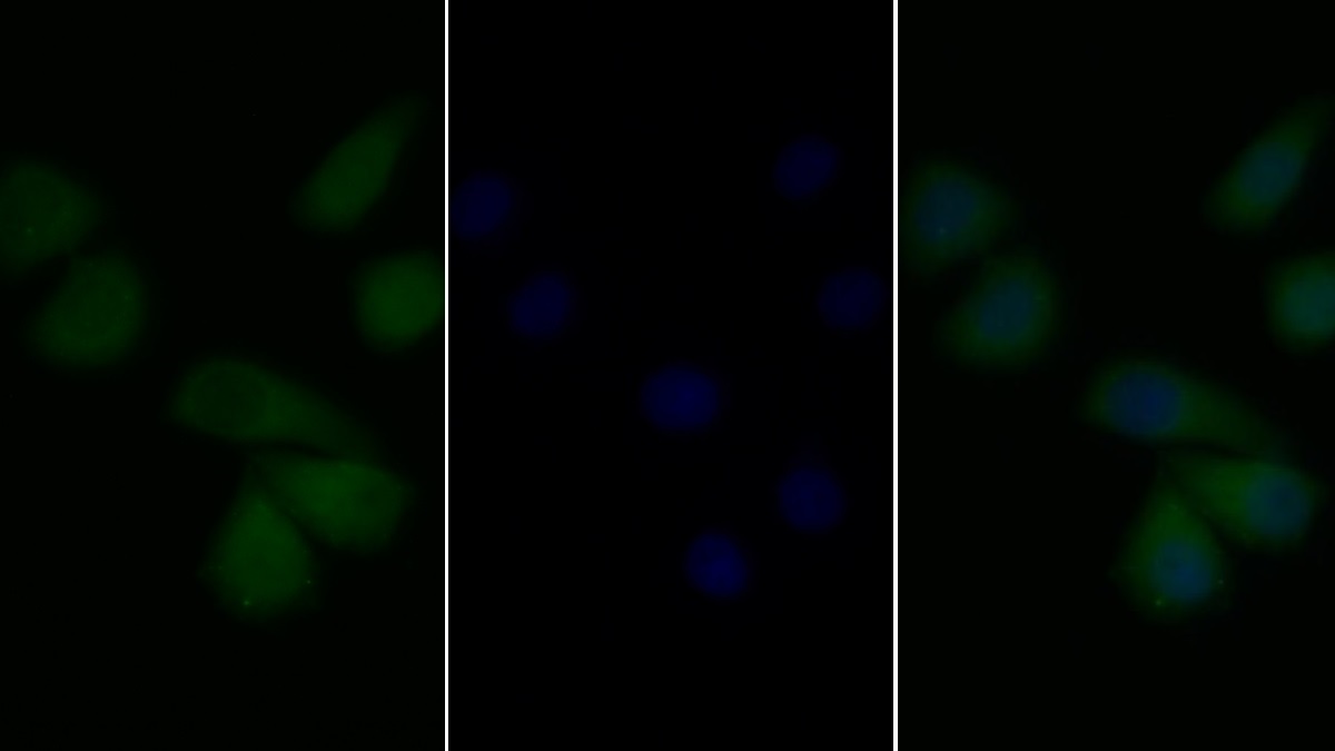 Anti-Platelet Derived Growth Factor Receptor Alpha (PDGFRa) Polyclonal Antibody