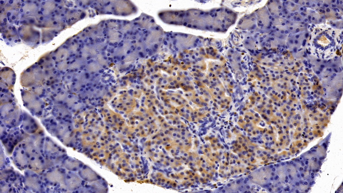 Monoclonal Antibody to Colony Stimulating Factor 3, Granulocyte (GCSF)