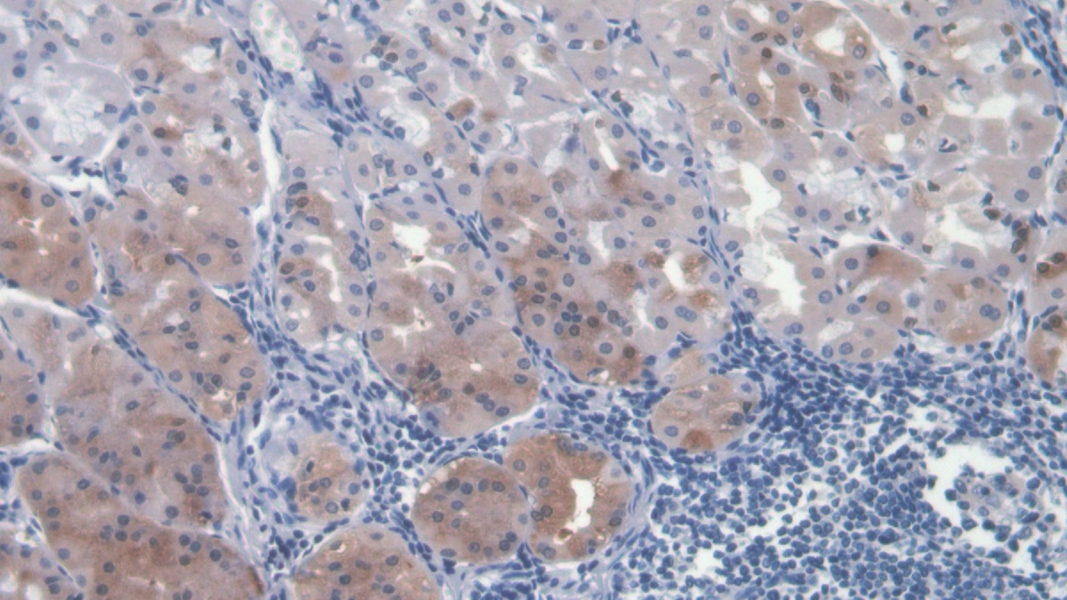 Monoclonal Antibody to Hepatocyte Growth Factor (HGF)