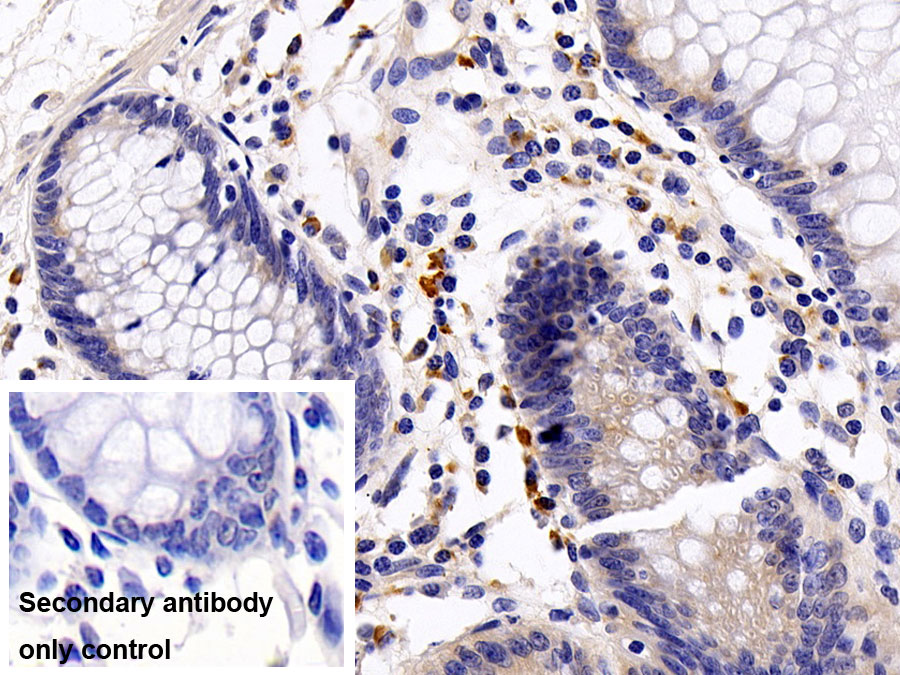 Monoclonal Antibody to Interleukin 8 (IL8)