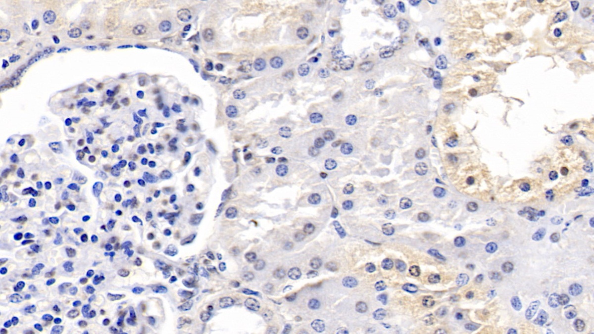 Monoclonal Antibody to Interleukin 9 (IL9)