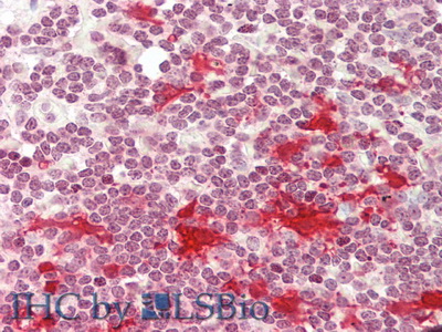 Monoclonal Antibody to Macrophage Derived Chemokine (MDC)