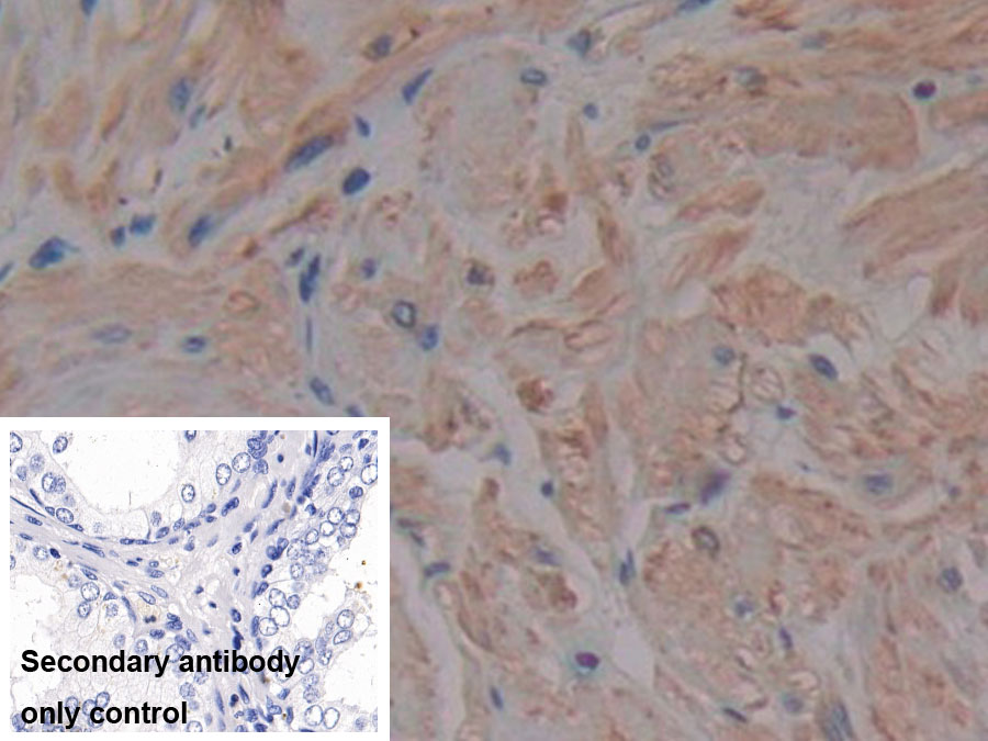 Monoclonal Antibody to Matrix Metalloproteinase 2 (MMP2)