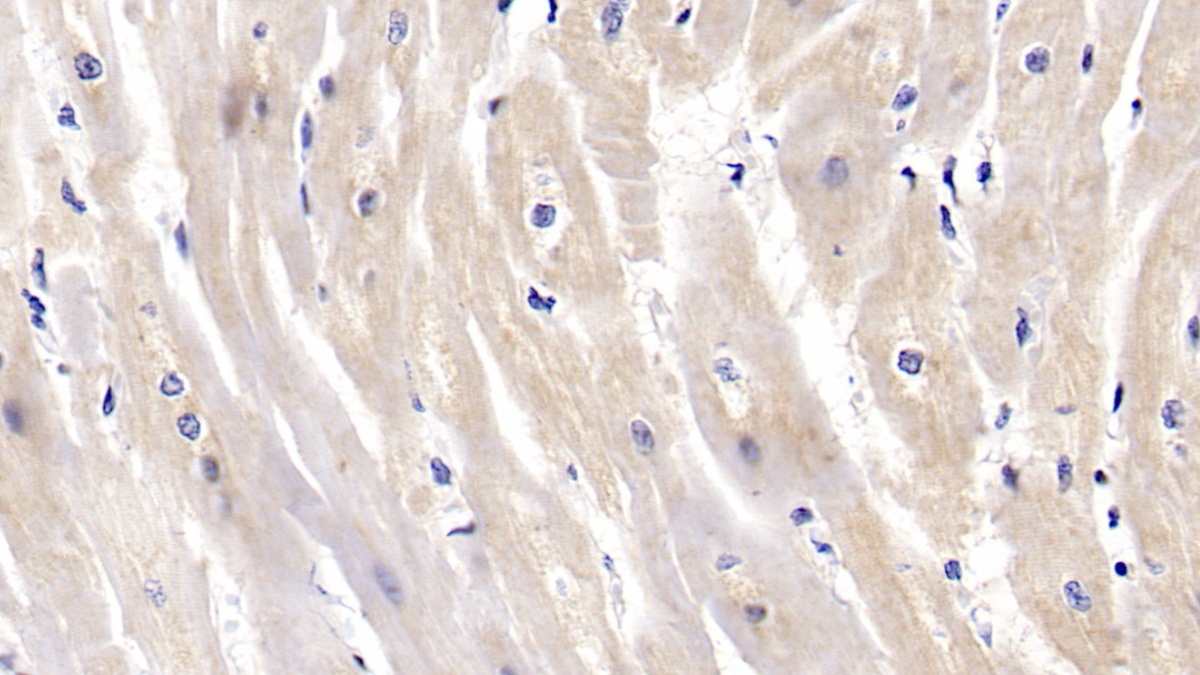 Monoclonal Antibody to N-Terminal Pro-Brain Natriuretic Peptide (NT-ProBNP)