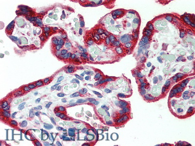 Monoclonal Antibody to Platelet Derived Growth Factor AA (PDGFAA)