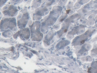 Monoclonal Antibody to Somatostatin (SST)