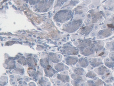 Monoclonal Antibody to Somatostatin (SST)