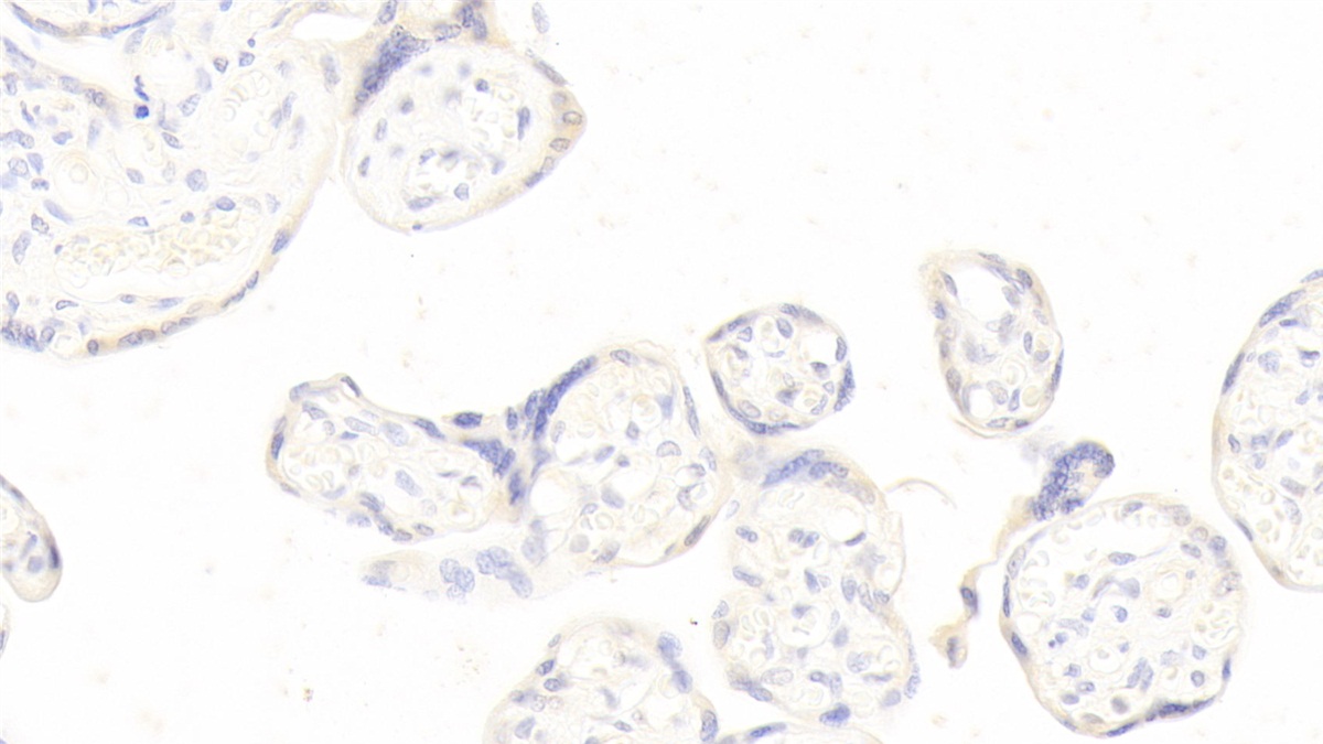 Monoclonal Antibody to Pregnancy Associated Plasma Protein A (PAPPA)