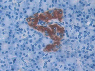 Monoclonal Antibody to Amylin
