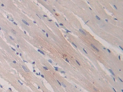 Monoclonal Antibody to Peroxisome Proliferator Activated Receptor Gamma (PPARg)