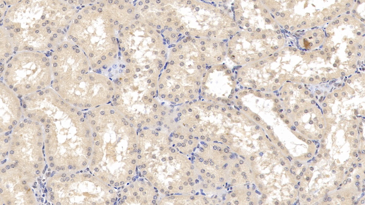 Monoclonal Antibody to Renin (REN)