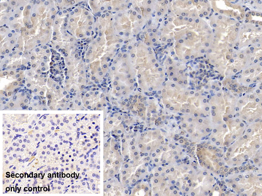 Monoclonal Antibody to Nephrin (NPHN)