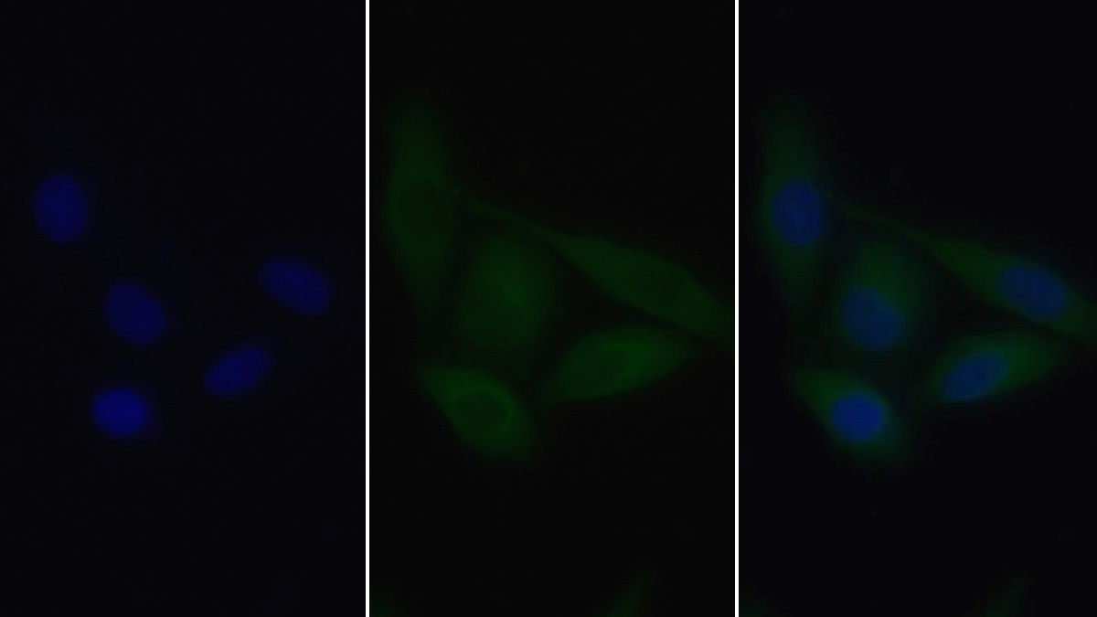 Monoclonal Antibody to Heart-type Fatty Acid Binding Protein (H-FABP)