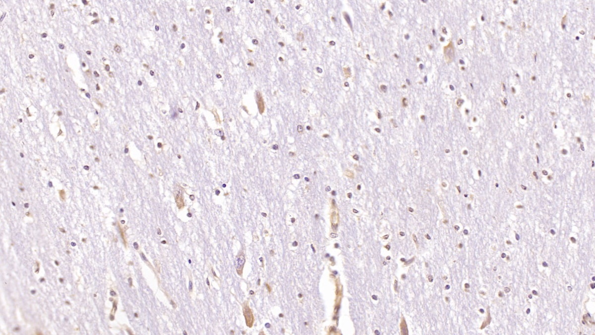 Monoclonal Antibody to Cluster Of Differentiation 97 (CD97)