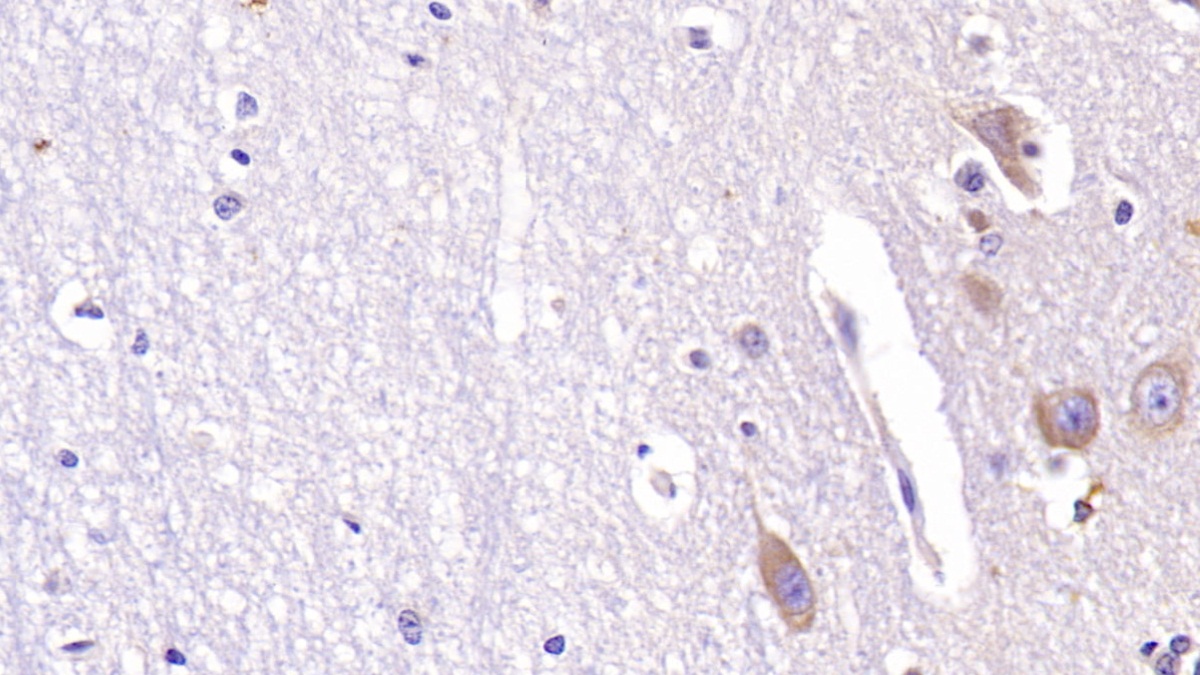 Monoclonal Antibody to Acetylcholinesterase (ACHE)