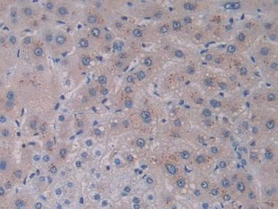 Monoclonal Antibody to Interleukin 28A (IL28A)