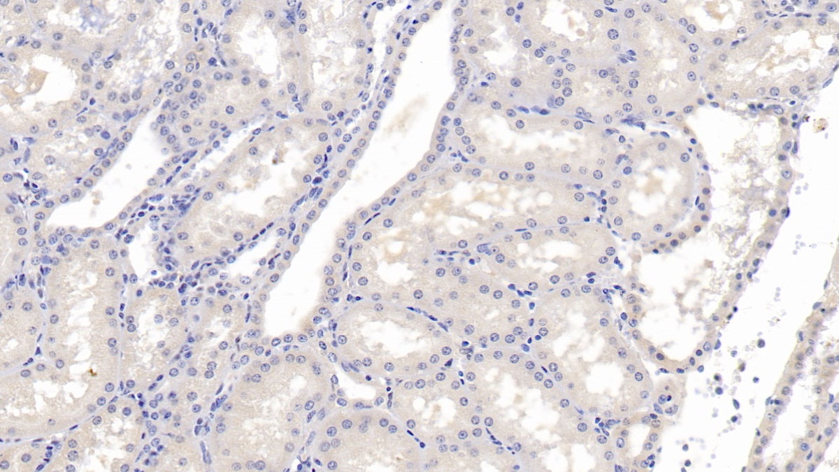 Monoclonal Antibody to Squamous Cell Carcinoma Antigen 1/2 (SCCA1/SCCA2)