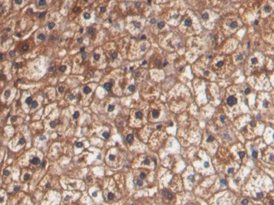Monoclonal Antibody to Haptoglobin Related Protein (HPR)
