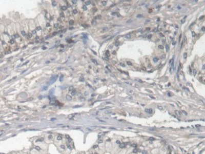 Monoclonal Antibody to Fibulin 1 (FBLN1)