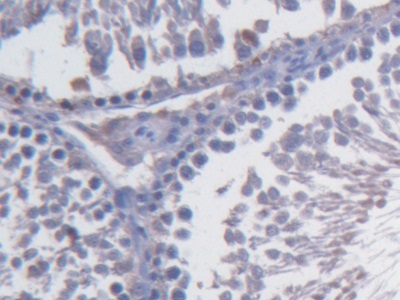 Monoclonal Antibody to Fibulin 1 (FBLN1)