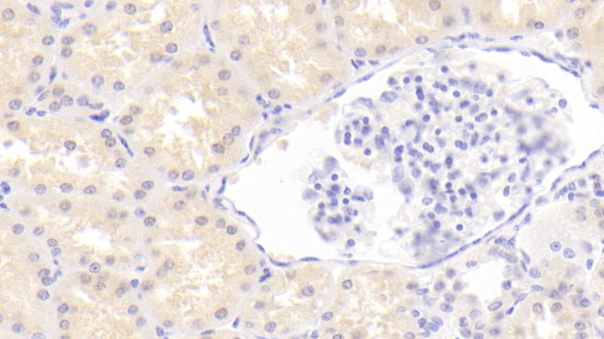 Monoclonal Antibody to Urea Transporter, Erythrocyte (UTE)